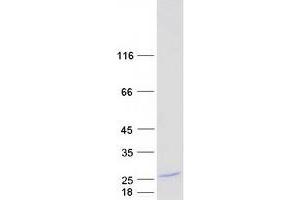 Validation with Western Blot