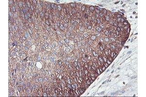 Image no. 9 for anti-phosphofructokinase, Platelet (PFKP) antibody (ABIN1500161)