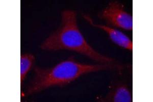 Immunofluorescence staining of methanol-fixed Hela cells using SHP-1(Phospho-Tyr536) Antibody.