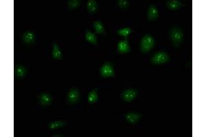 Immunofluorescence staining of A549 cells with ABIN7155365 at 1:133, counter-stained with DAPI. (HIST1H2AC anticorps  (AA 2-130))