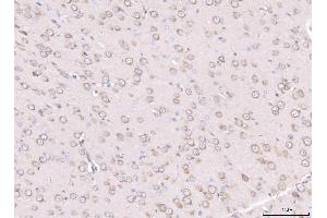 IHC analysis of RPL29 using anti-RPL29 antibody (ABIN7600993). (RPL29 anticorps  (AA 27-153))