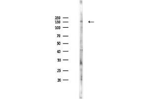 Western blot analysis of lysates from K562 cells(heat-shock 45 min treatment), using Phospho-VEGFR2 (Tyr1059) Antibody at 1/1000 dilution.
