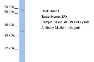 Host: Rabbit Target Name: ZFX Sample Type: ACHN Whole cell lysates Antibody Dilution: 1. (ZFX anticorps  (C-Term))