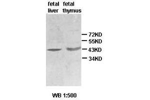 Western blot analysis of fetal liver and thymus lysate, using ACTBL2 antibody. (ACTBL2 anticorps  (Middle Region))