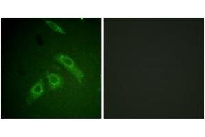 Immunofluorescence analysis of HepG2 cells, using FAK (Phospho-Ser910) Antibody. (FAK anticorps  (pSer910))