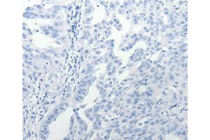 Immunohistochemistry (IHC) image for anti-USO1 Homolog, Vesicle Docking Protein (USO1) antibody (ABIN1875291) (USO1 anticorps)