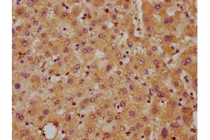 IHC image of ABIN7149649 diluted at 1:700 and staining in paraffin-embedded human liver tissue performed on a Leica BondTM system.