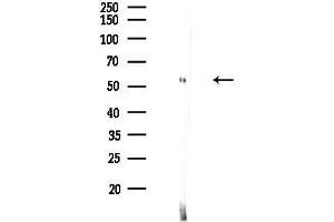 Western blot analysis of lysates from HepG2 cells(UV,30 min treatment), using Hck Antibody at 1/1000 dilution.
