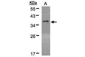 WB Image Sample(30 μg of whole cell lysate) A:H1299 12% SDS PAGE antibody diluted at 1:500 (EIF2A anticorps  (Center))