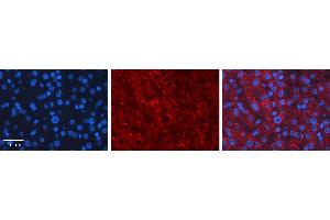 Immunohistochemistry (IHC) image for anti-Lecithin-Cholesterol Acyltransferase (LCAT) (C-Term) antibody (ABIN2776942)