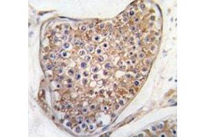 IHC analysis of FFPE human testis tissue stained with TIE2 antibody