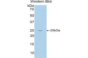 Western blot analysis of the recombinant protein. (IL-27 anticorps  (AA 32-234))