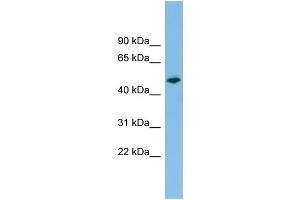 WB Suggested Anti-PTPRR Antibody Titration: 0. (PTPRR anticorps  (N-Term))