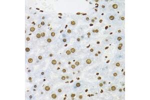 Immunohistochemistry of paraffin-embedded mouse liver using KHDRBS1 antibody (ABIN5975824) at dilution of 1/100 (40x lens). (KHDRBS1 anticorps)