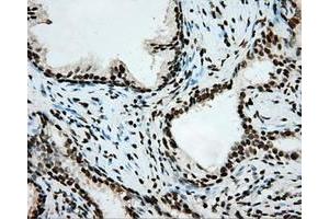 Image no. 3 for anti-Aryl Hydrocarbon Receptor Nuclear Translocator (ARNT) antibody (ABIN1496729) (ARNT anticorps)