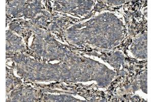 IHC analysis of Caspase-7/CASP7 using anti-Caspase-7/CASP7 antibody (ABIN7600823). (Caspase 7 anticorps  (AA 24-303))