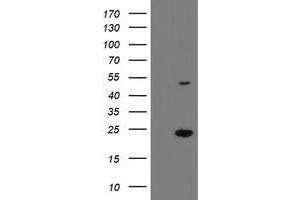 Western Blotting (WB) image for anti-Eukaryotic Translation Initiation Factor 5A2 (EIF5A2) antibody (ABIN1497996) (EIF5A2 anticorps)