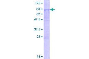 Image no. 1 for Zinc Finger, CCHC Domain Containing 6 (ZCCHC6) (AA 1-412) protein (GST tag) (ABIN1325669)