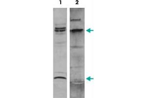 Western Blot (Cell lysate) analysis of nuclear extracts of ME-1 cells. (MYH11 anticorps  (C-Term))