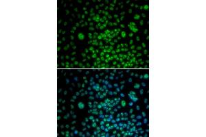 Immunofluorescence analysis of U20S cell using MAX antibody. (MAX anticorps)