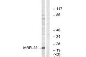 Western Blotting (WB) image for anti-Mitochondrial Ribosomal Protein L22 (MRPL22) (AA 91-140) antibody (ABIN2890053)