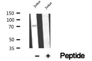 Western blot analysis of extracts of Jurkat cells, using CCDC93 antibody. (CCDC93 anticorps  (C-Term))