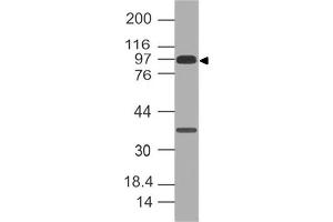 Image no. 1 for anti-Cadherin 1, Type 1, E-Cadherin (Epithelial) (CDH1) (AA 438-556) antibody (ABIN5027172)