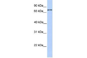 WB Suggested Anti-COLEC12 Antibody Titration:  0. (COLEC12 anticorps  (N-Term))