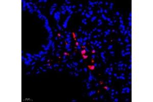 Immunofluorescence of paraffin embedded mouse lung using BIRC3 (ABIN7073179) at dilution of 1: 1000 (400x lens)