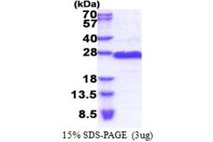 G Antigen 2D (GAGE2D) (AA 1-116) protein (His tag)
