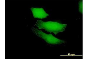 Immunofluorescence of purified MaxPab antibody to RGS13 on HeLa cell.