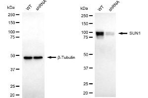 Western blotting analysis using SUN1 antibody (ABIN7800268). (Recombinant SUN1 anticorps)