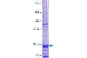 SDS-PAGE (SDS) image for Thymic Stromal Lymphopoietin (TSLP) (AA 1-60) protein (GST tag) (ABIN1800132)