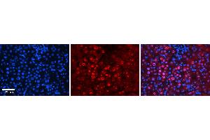 Rabbit Anti-FOS Antibody  AV Formalin Fixed Paraffin Embedded Tissue: Human Liver Tissue Observed Staining: Nucleus in hepatocytes Primary Antibody Concentration: 1:100 Other Working Concentrations: 1:600 Secondary Antibody: Donkey anti-Rabbit-Cy3 Secondary Antibody Concentration: 1:200 Magnification: 20X Exposure Time: 0. (c-FOS anticorps  (N-Term))