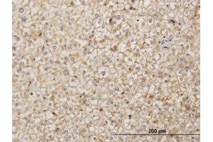 Image no. 1 for anti-Stromal Cell Derived Factor 2 (SDF2) (AA 1-212) antibody (ABIN598919) (SDF2 anticorps  (AA 1-212))
