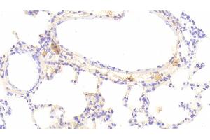Detection of IFNb in Rat Lung Tissue using Monoclonal Antibody to Interferon Beta (IFNb) (IFNB1 anticorps  (AA 23-169))