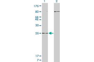 Western Blot analysis of HOXB7 expression in transfected 293T cell line by HOXB7 monoclonal antibody (M04), clone 5B2.