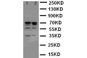 Anti-Lamin A+C antibody, Western blotting Lane 1: HELA Cell Lysate Lane 2: A431 Cell Lysate (Lamin A/C anticorps  (C-Term))