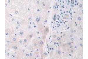 Detection of IL12A in Human Liver Tissue using Polyclonal Antibody to Interleukin 12A (IL12A)
