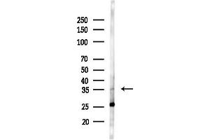 anti-Left-Right Determination Factor 1 (LEFTY1) (Internal Region) antibody