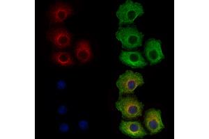 ABIN6262561 and ABIN6278898 staining Hela cells by IF/ICC. (IL28B anticorps  (Internal Region))
