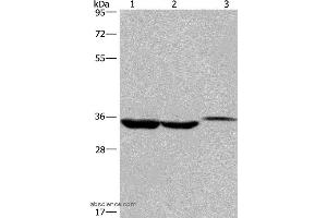 Western blot analysis of Lovo cell,human liver cancer tissue and mouse kidney tissue, using ING2 Polyclonal Antibody at dilution of 1:425 (ING2 anticorps)