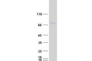 Validation with Western Blot