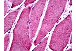 Anti-ATP11B antibody IHC of human skeletal muscle.