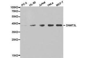 Western Blotting (WB) image for anti-DNA (Cytosine-5-)-Methyltransferase 3 Like (TRDMT1) antibody (ABIN1872332) (DNMT3L anticorps)