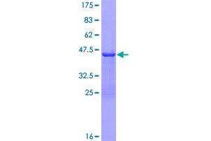 Image no. 1 for Prothymosin, alpha (PTMA) (AA 1-110) protein (GST tag) (ABIN1316787)