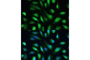 Immunofluorescence analysis of U-2 OS cells using Galectin 3/Galectin 3/LG antibody (ABIN6130437, ABIN6143158, ABIN6143159 and ABIN7101422) at dilution of 1:100.