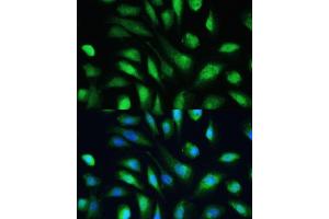 Immunofluorescence analysis of U-2 OS cells using Galectin 3/Galectin 3/LG antibody (ABIN6130437, ABIN6143158, ABIN6143159 and ABIN7101422) at dilution of 1:100. (Galectin 3 anticorps  (AA 1-250))