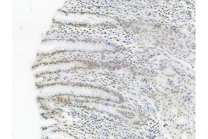 ABIN6256471 and ABIN6267557 at 1/100 staining human normal gastric tissue by IHC-P.