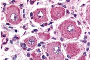 Human Spinal Cord, Dorsal Root Ganglion (formalin-fixed, paraffin-embedded) stained with GPR149 antibody ABIN213496 at 2.